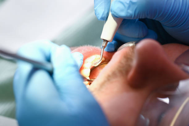 Best Tooth Infection Emergency Dentist  in Coronita, CA